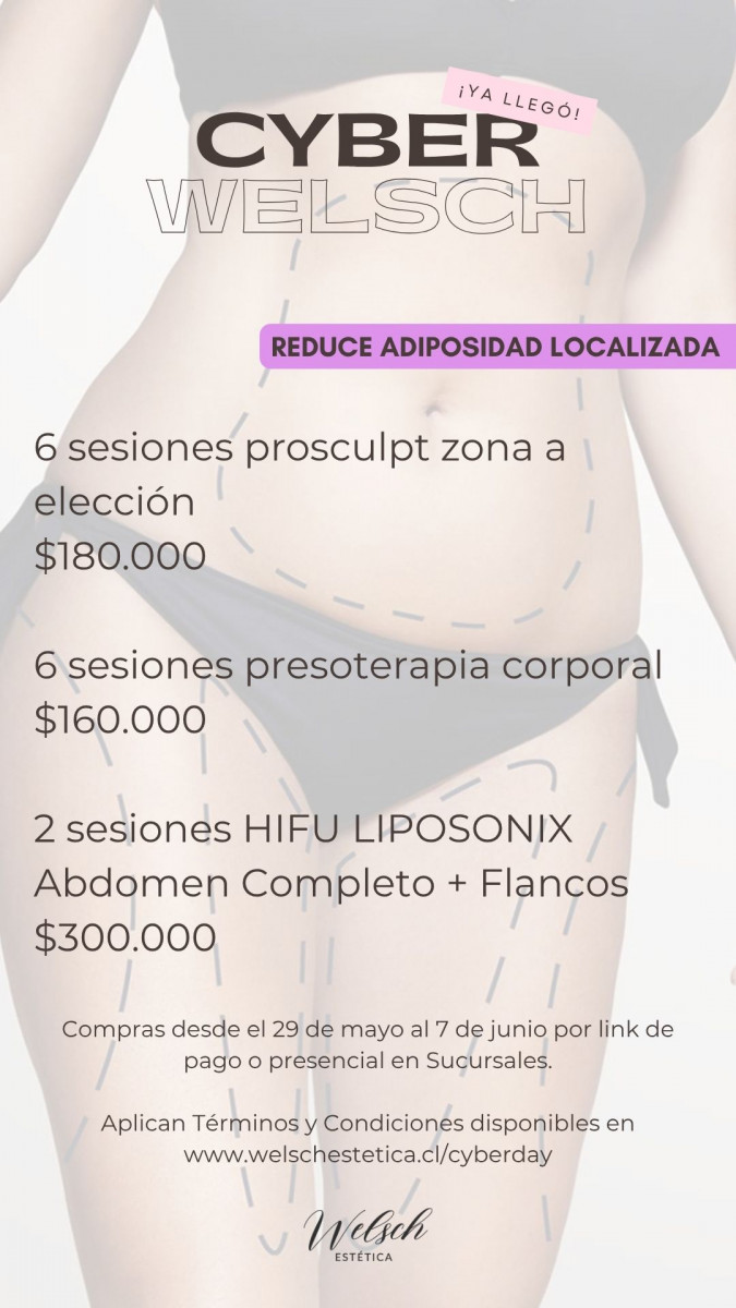 Welsch Estetica 10  