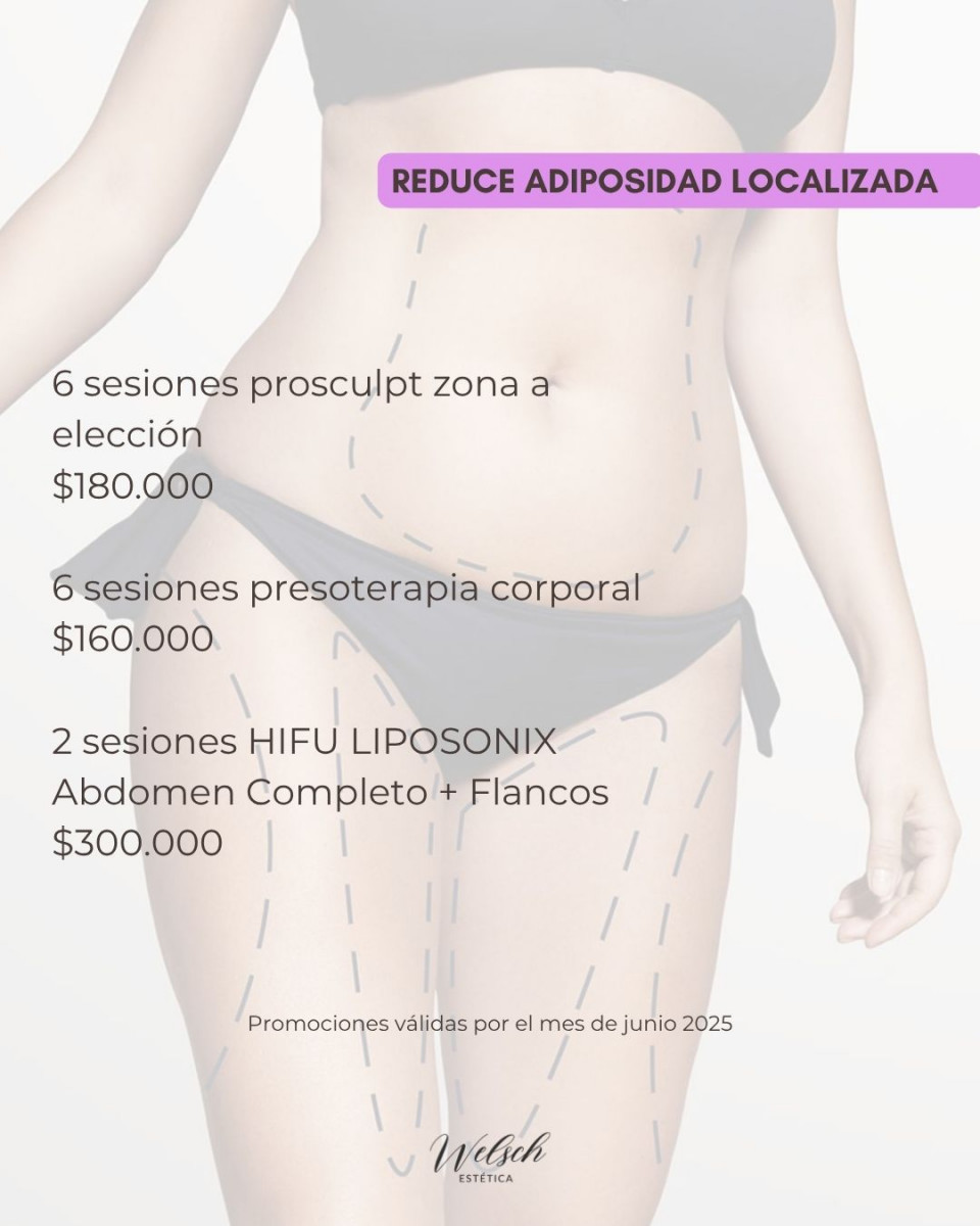 Welsch Estetica 9  