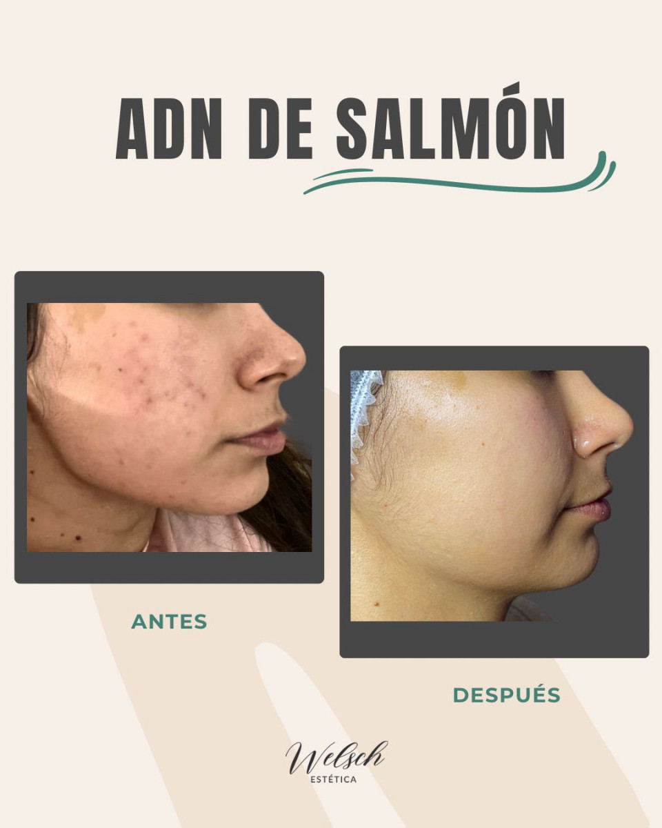 Welsch Estetica WhatsApp-Image-2025-06-01-at-10.23.11-PM  