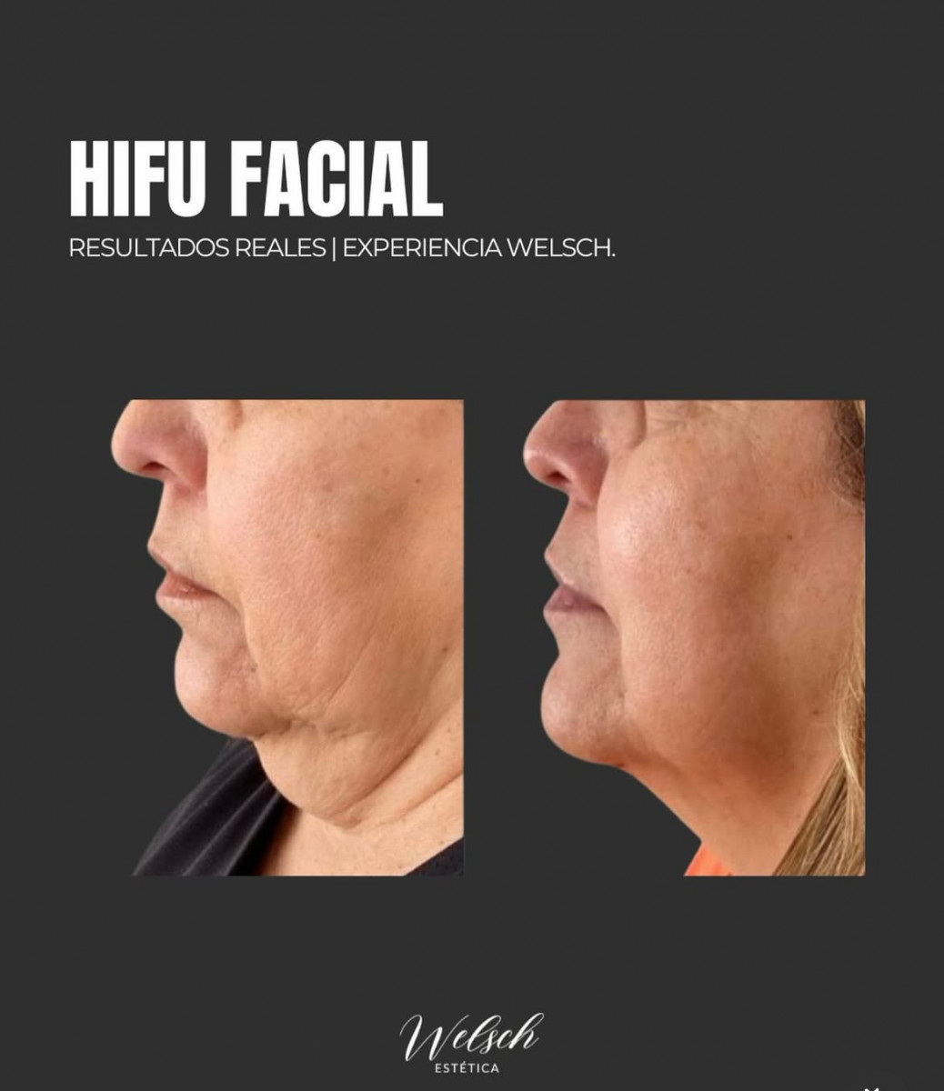 Welsch Estetica IMG_6821  