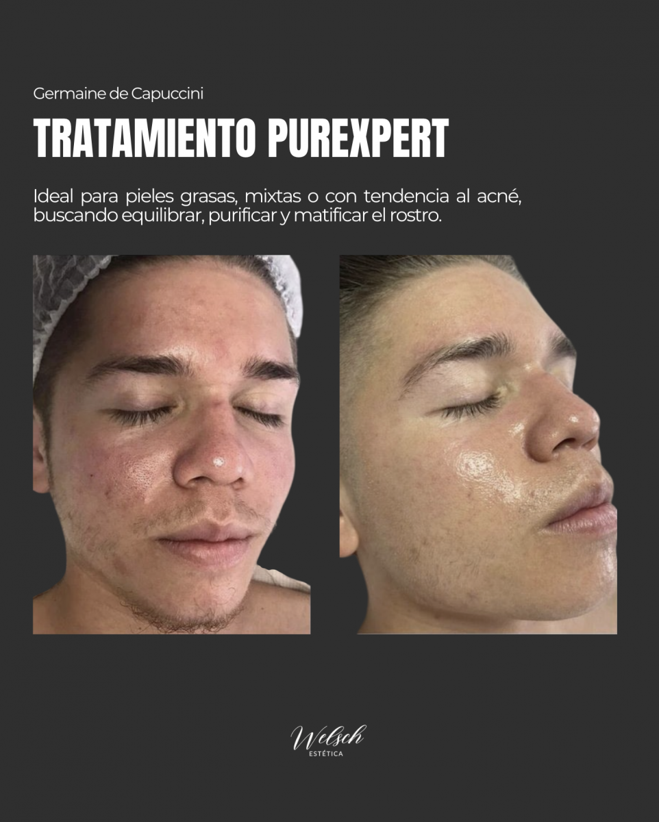 Welsch Estetica Captura-de-pantalla-2026-03-16-a-las-1.08.58-p.m  