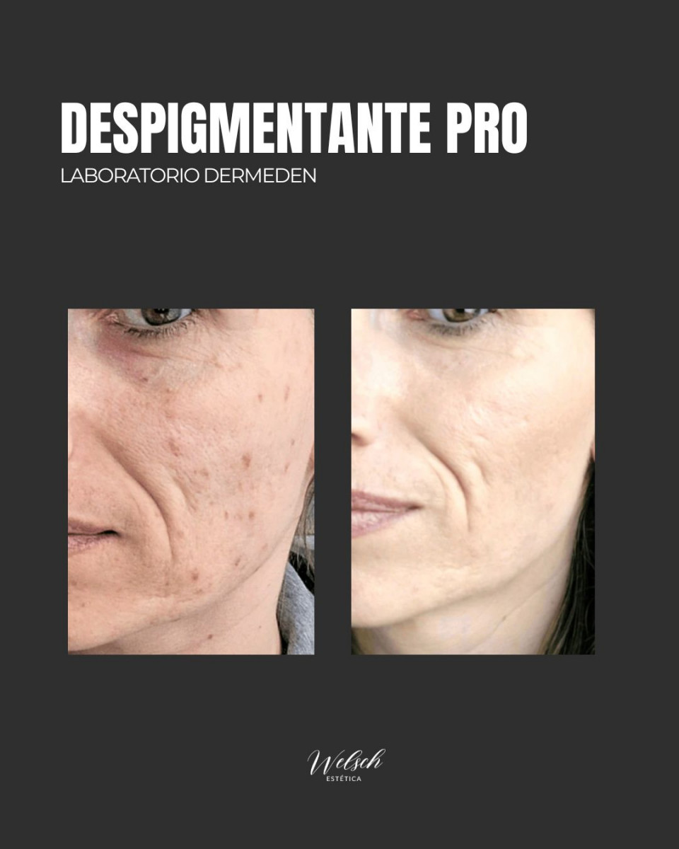 Welsch Estetica Copia-de-Post-para-Instagram-3-Tips-Conejos-para-Nenis-Emprendedoras-Llamativo-Rosa-y-Negro-1080-x-1080-px-1080-x-1080-px-Post-de-Instagram-45-1  