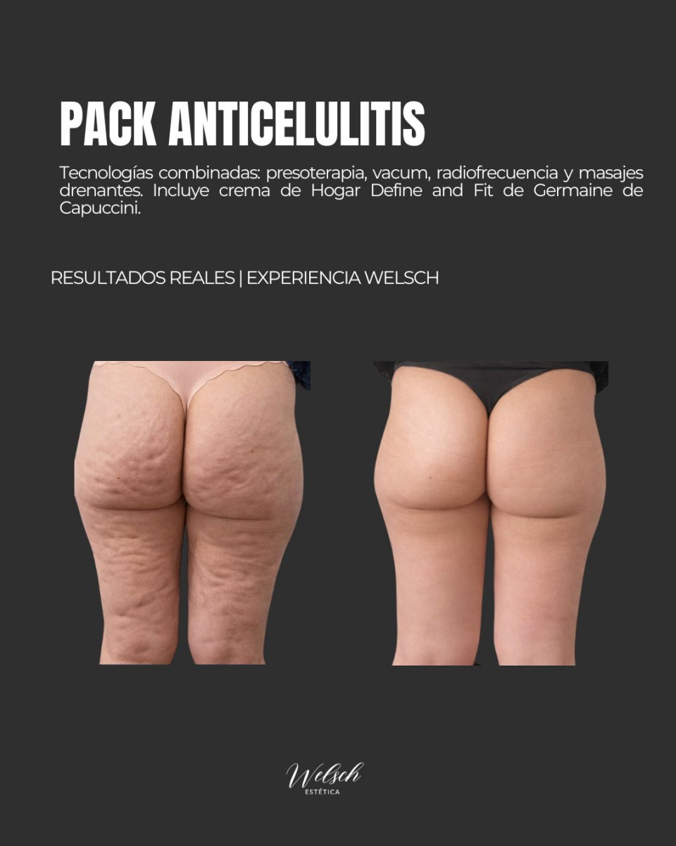 Welsch Estetica Copia-de-Post-para-Instagram-3-Tips-Conejos-para-Nenis-Emprendedoras-Llamativo-Rosa-y-Negro-1080-x-1080-px-1080-x-1080-px-Post-de-Instagram-45  