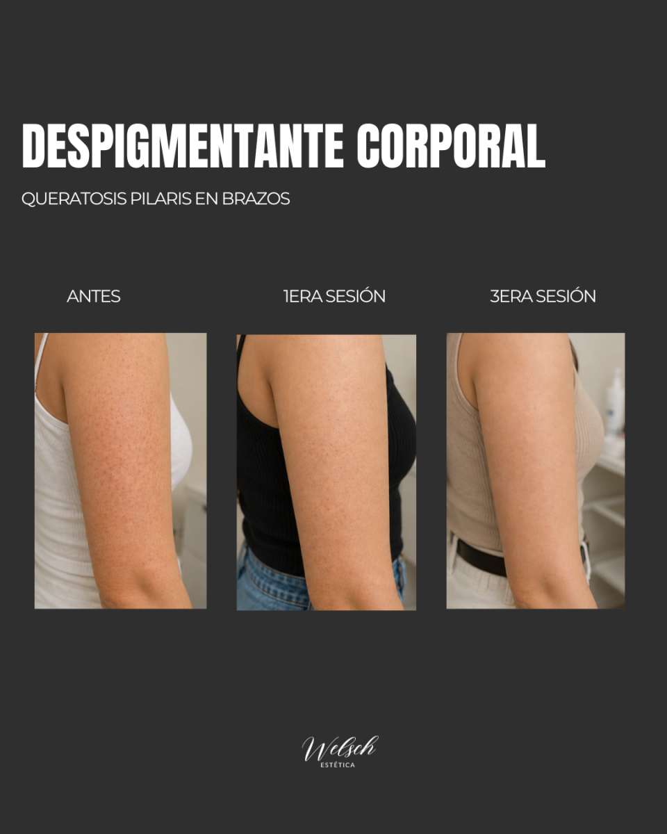 Welsch Estetica Copia-de-Post-para-Instagram-3-Tips-Conejos-para-Nenis-Emprendedoras-Llamativo-Rosa-y-Negro-1080-x-1080-px-1080-x-1080-px-Post-de-Instagram-45-1-1  