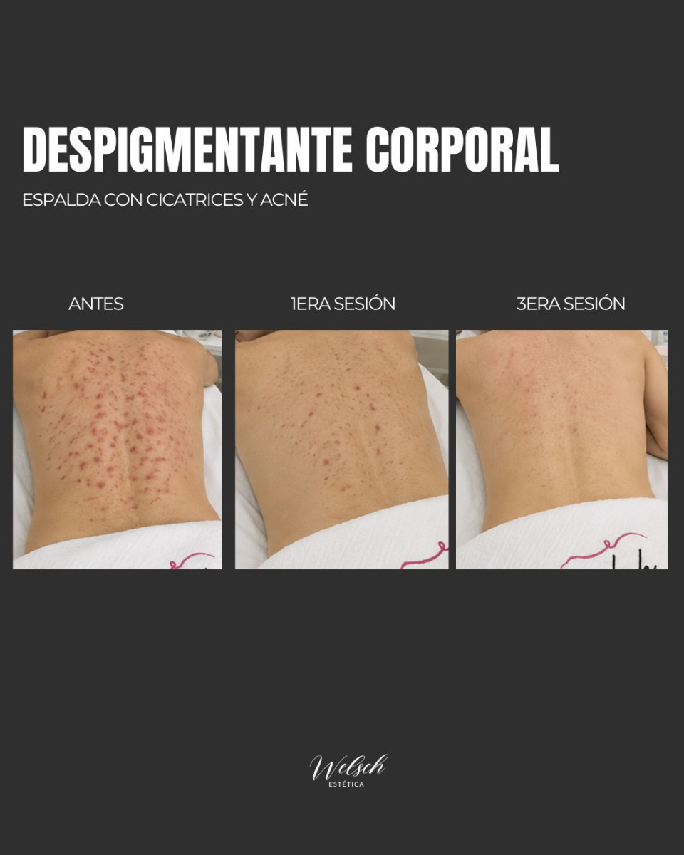 Welsch Estetica Copia-de-Post-para-Instagram-3-Tips-Conejos-para-Nenis-Emprendedoras-Llamativo-Rosa-y-Negro-1080-x-1080-px-1080-x-1080-px-Post-de-Instagram-45-2  